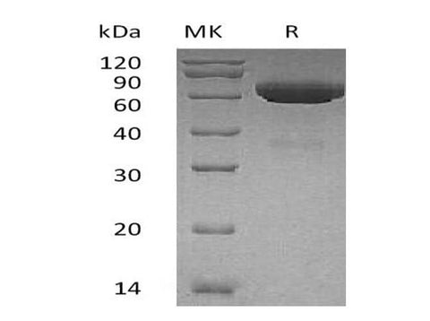 Recombinant Human tPA/PLAT Protein (His Tag) - ABMIUM