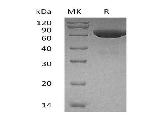 Recombinant Human tPA/PLAT Protein (His Tag) - ABMIUM