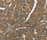 Anti-Human PTPN20 Antibody - ABMIUM
