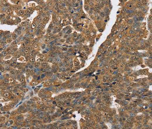 Anti-Human PTPN20 Antibody