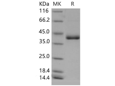 Recombinant Mouse CD59a/MAC-IP Protein (Fc Tag) - ABMIUM