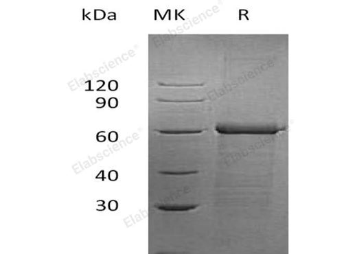 Recombinant Human UBAP1 Protein (His Tag) - ABMIUM