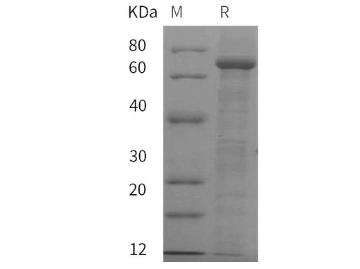 SDS-PAGE analysis of Rat C4 proteins, 2 μg/lane of Recombinant Rat C4 proteins was resolved with SDS-PAGE under reducing conditions, showing bands at 70 kDa.