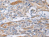 Anti-Human/Mouse/Rat FBXO45 Antibody - ABMIUM