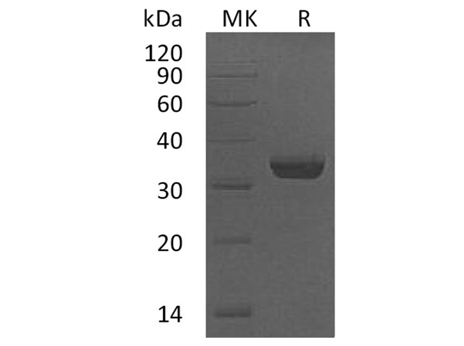 Recombinant Human LMAN2/VIP36 Protein (Human Cells, His Tag) - ABMIUM