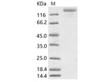 Recombinant HCoV-NL63 S1+S2 Protein (ECD, His Tag) - ABMIUM