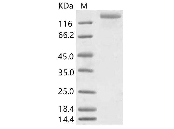 Recombinant HCoV-NL63 S1+S2 Protein (ECD, His Tag) - ABMIUM