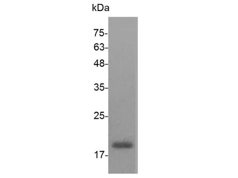 > 98 % as determined by reducing SDS-PAGE.