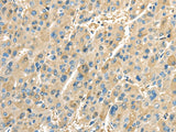 Anti-Human/Mouse/Rat PTGS2 Antibody - ABMIUM