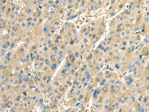 Anti-Human/Mouse/Rat PTGS2 Antibody