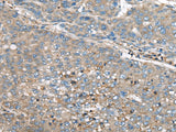 Anti-Human/Mouse/Rat GULP1 Antibody - ABMIUM