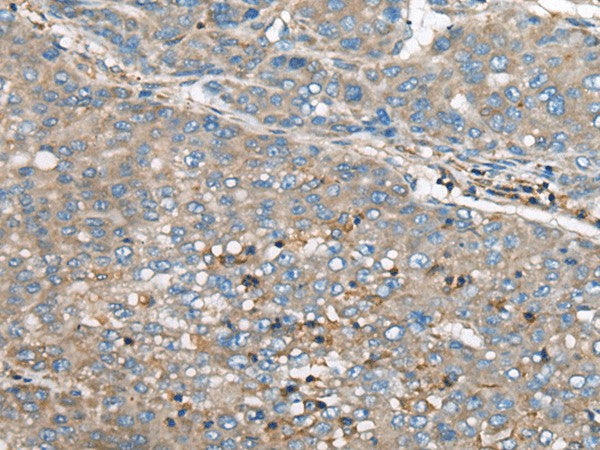 Anti-Human/Mouse/Rat GULP1 Antibody - ABMIUM