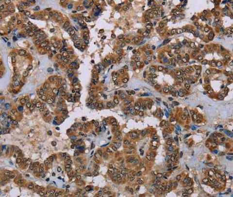 Anti-Human/Mouse/Rat GRK1 Antibody