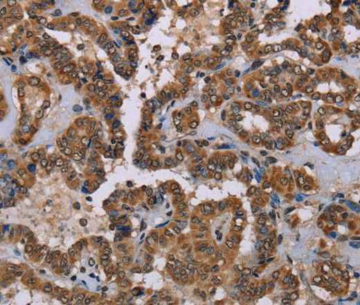 Anti-Human/Mouse/Rat GRK1 Antibody