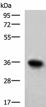 Western blot analysis of Mouse skeletal muscle tissue lysate using TNNT1 Polyclonal Antibody at dilution of 1:550