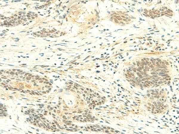 Anti-Human/Mouse ATMIN Antibody