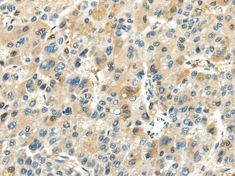 Anti-Human TRAIP Antibody - ABMIUM