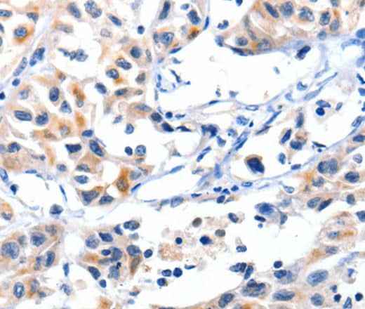 Anti-Human/Mouse/Rat FBLN5 Antibody
