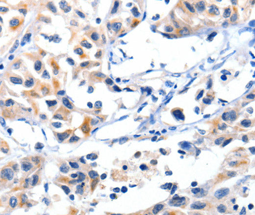 Anti-Human/Mouse/Rat FBLN5 Antibody - ABMIUM