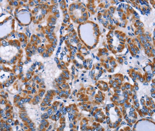 Anti-Human/Mouse INTS10 Antibody - ABMIUM