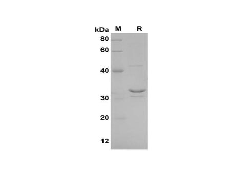 SDS-PAGE analysis of Human XCL1/Lymphotactin proteins, 2 μg/lane of Recombinant Human XCL1/Lymphotactin proteins was resolved with SDS-PAGE under reducing conditions, showing bands at 32 kDa.