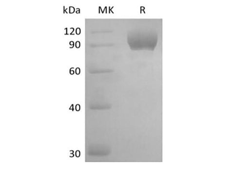 Recombinant Mouse Tyrosine-protein kinase receptor UFO/AXL oncogene/UFO (C-FC) - ABMIUM
