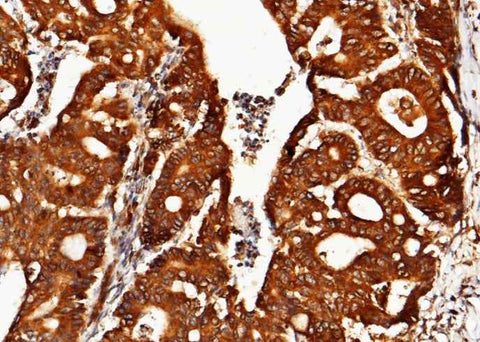 Anti-Human HYOU1 Antibody [B325] - ABMIUM
