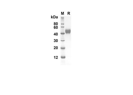 SDS-PAGE analysis of Mouse IL-5 proteins, 2 μg/lane of Recombinant Mouse IL-5 proteins was resolved with SDS-PAGE under reducing conditions, showing bands at 39.5 kDa.
