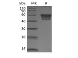 Recombinant Human CD82 (N-Fc) - ABMIUM