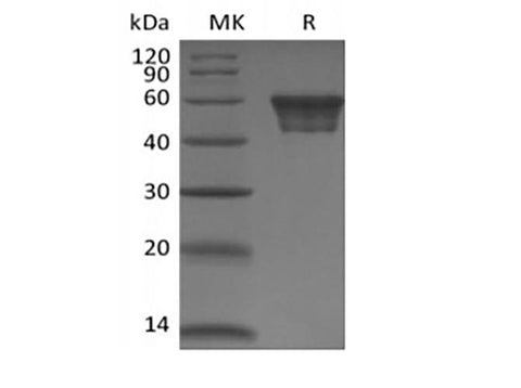 Recombinant Human CD82 (N-Fc) - ABMIUM
