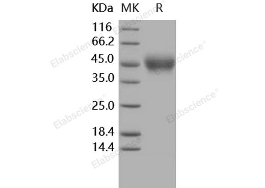 > 98 % as determined by reducing SDS-PAGE.