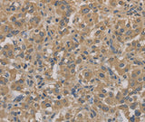 Anti-Human AGTRAP Antibody - ABMIUM