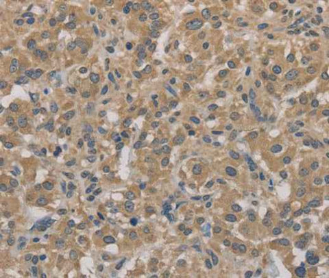 Anti-Human AGTRAP Antibody