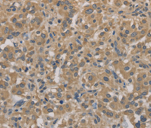 Anti-Human AGTRAP Antibody - ABMIUM