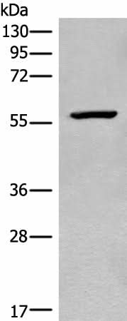 Western blot analysis of Mouse heart tissue lysate using CDADC1 Polyclonal Antibody at dilution of 1:450