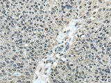 Anti-Human/Mouse FUS Antibody - ABMIUM