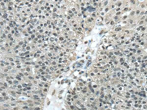 Anti-Human/Mouse FUS Antibody