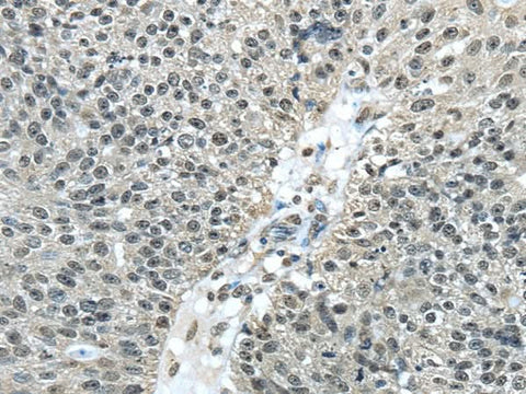Anti-Human/Mouse FUS Antibody - ABMIUM