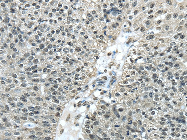 Anti-Human/Mouse FUS Antibody - ABMIUM