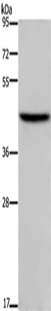 Anti-Human/Mouse TFDP1 Antibody - ABMIUM