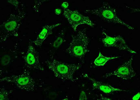 Anti-Human PPM1G Antibody [B147] - ABMIUM