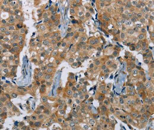 Anti-Human/Mouse PLXNA4 Antibody