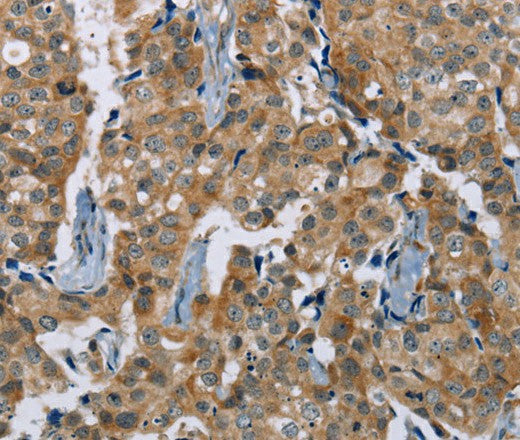 Anti-Human/Mouse PLXNA4 Antibody - ABMIUM