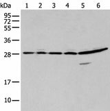 Western blot analysis of 293T A549 and Hela cell using SFN Polyclonal Antibody at dilution of 1:250