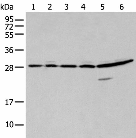 Western blot analysis of 293T A549 and Hela cell using SFN Polyclonal Antibody at dilution of 1:250