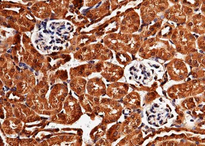 Anti-Mouse SCARB2 Antibody [B392] - ABMIUM