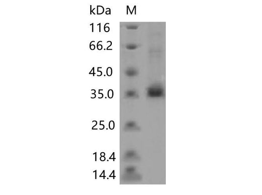 > 85 % as determined by reducing SDS-PAGE.