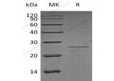 Recombinant Human EIF4E Protein - ABMIUM