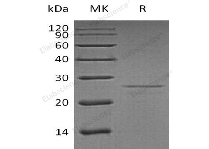 Recombinant Human EIF4E Protein - ABMIUM