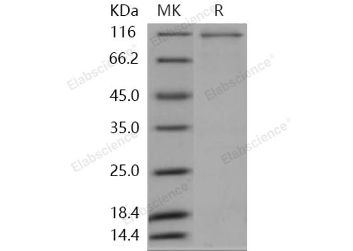 > 87 % as determined by reducing SDS-PAGE.